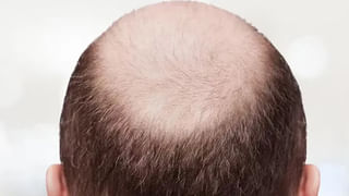 ముఖంపై తేనె రాసుకోవడం ప్రయోజనమేనా.? నిపుణుల మాటేంటి.?