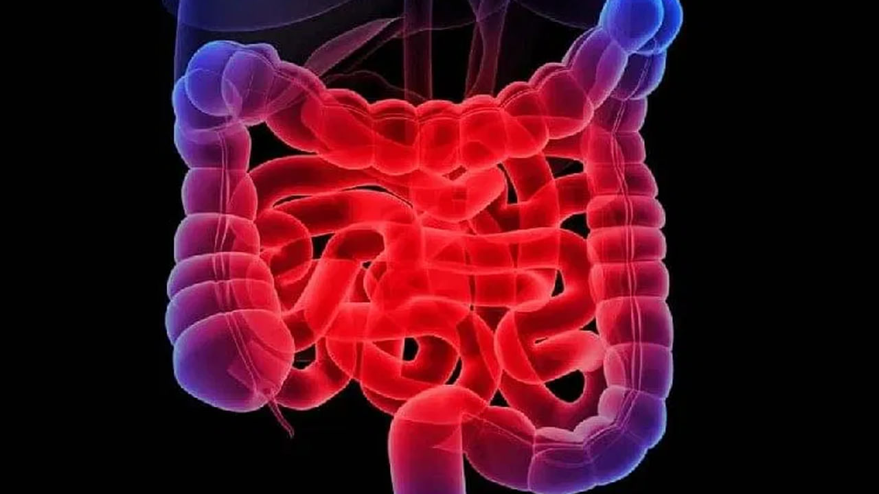 గతంతో పోలిస్తే ఈ మధ్య కాలంలో పెద్దపేగు క్యాన్సర్స్ విపరీతంగా పెరుగుతున్నాయంట.దాదాపు 3.2 శాతం అధికంగా కేసులు నమోదు అవుతున్నాయని చెబుతున్నారు ఆరోగ్య నిపుణులు. కాగా, ఇప్పుడు మనం అసలు పెద్ద పేగు క్యాన్సర్ అంటే ఏంటీ? దీని ప్రారంభ లక్షాలు ఏవో వివరంగా తెలుసుకుందాం.