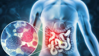 ఐల్యాష్ అతిగా ఉపయోగిస్తున్నారా.? సమస్యలను కొని తెచ్చుకున్నట్టే..