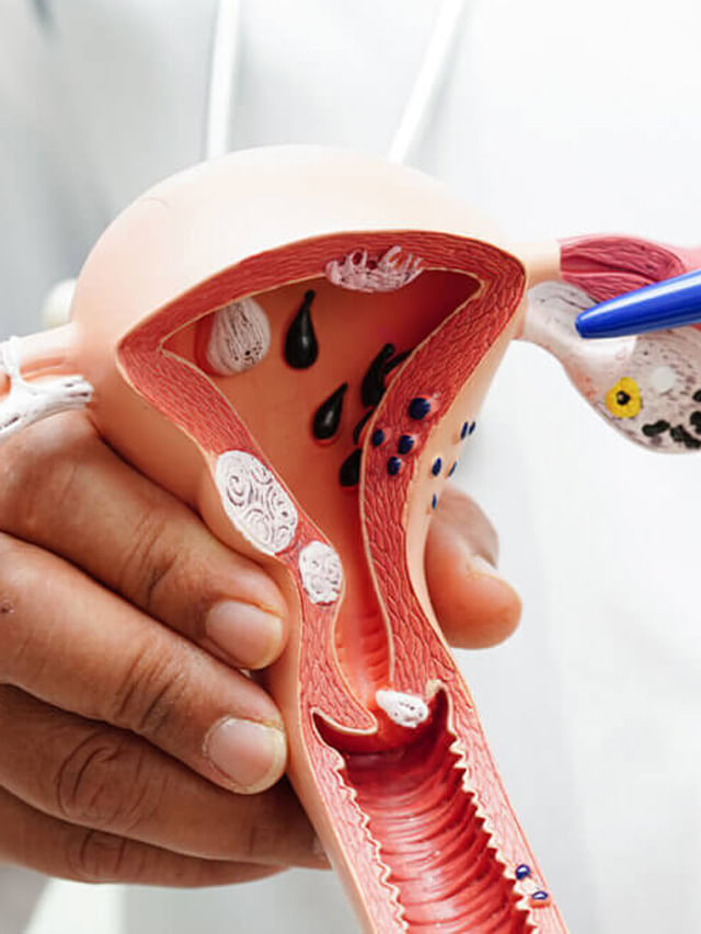 మగువలూ.. ఈ లక్షణాలు ఉన్నాయా.? గర్భాశయ క్యాన్సర్ కావచ్చు.. జార పైలం..