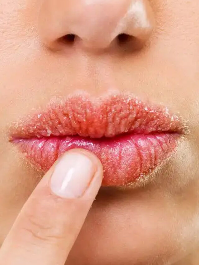 చలికాలంలో పెదువులు పగిలిపోతున్నాయా? సింపుల్ టిప్స్ మీ కోసం!