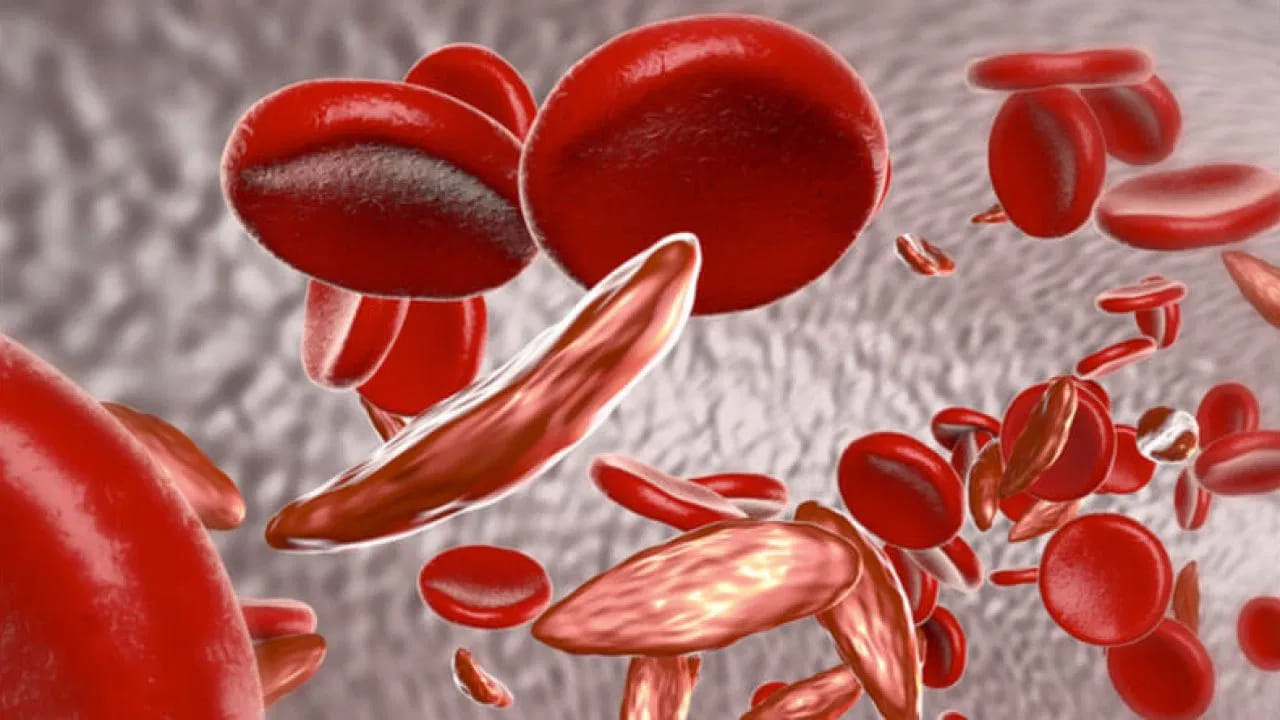 రక్తహీనత ప్రమాదం : ఎవరైతే సరిగ్గా నీరు తాగరో, వారు రక్తహీనతకు గురి అయ్యే ఛాన్స్ ఉన్నదంట. శరీరానికి తగింత నీరు తాగకపోవడం వలన ఇది రక్తప్రసరణపై ప్రభావం చూపుతుంది. దీని వలన రక్తంలో హిమోగ్లోబిన్ స్థాయిలు తగ్గిపోయి, చాలా సమస్యలు వస్తాయంట. అందుకే తప్పకుండా శరీరానికి తగిన నీరు తాగడం తప్పనిసరి అని చెబుతున్నారు ఆరోగ్య నిపుణులు.