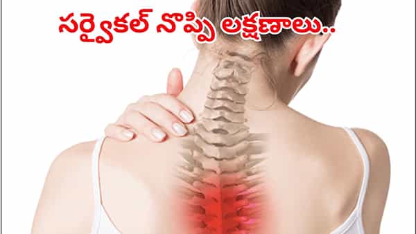 Cervical Pain Remedies: ఇవన్నీ సర్వైకల్ సమస్యకు ప్రారంభ లక్షణాలు..! నిర్లక్ష్యం చేస్తే తప్పదు మూల్యం..