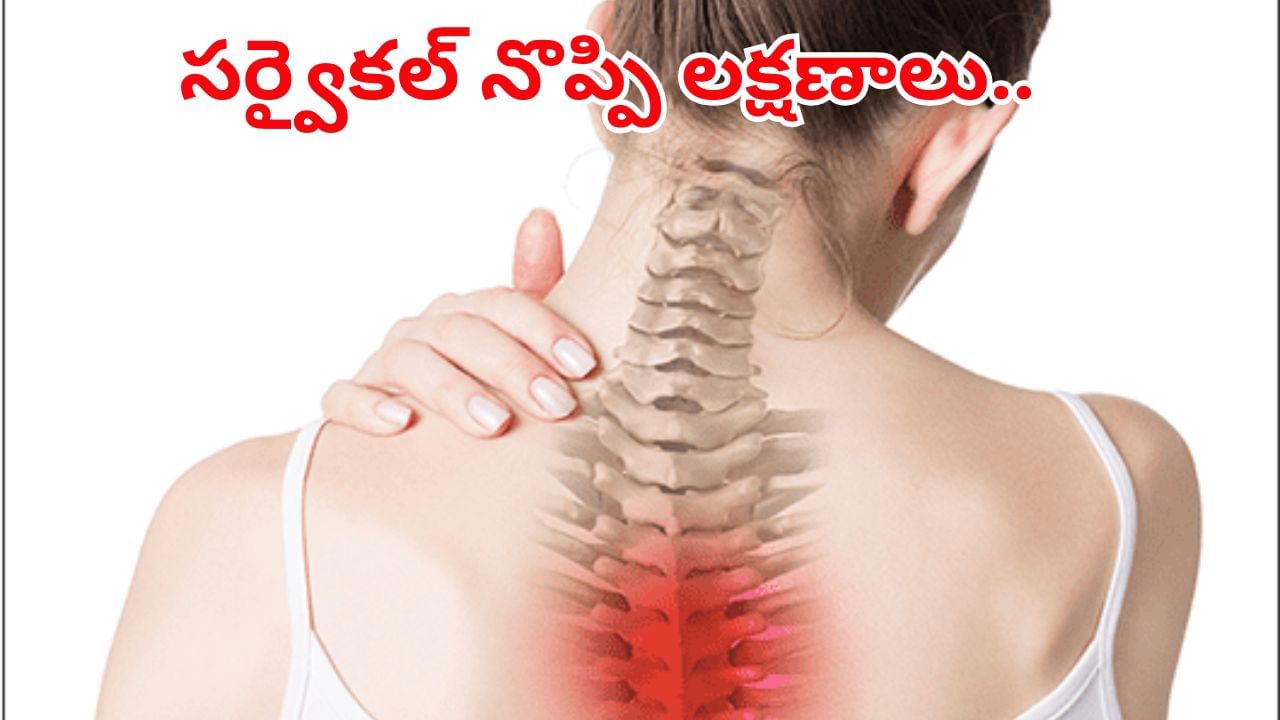 Cervical Pain Remedies: ఇవన్నీ సర్వైకల్ సమస్యకు ప్రారంభ లక్షణాలు..! నిర్లక్ష్యం చేస్తే తప్పదు మూల్యం..