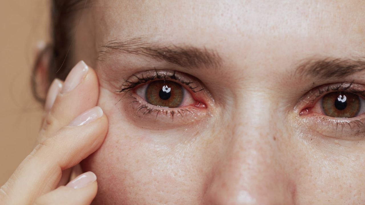 Eyes: మీ కళ్లులో ఈ మార్పులను అస్సలు లైట్ తీసుకోకండి..! ఆ ప్రమాదకర వ్యాధికి సంకేతం కావచ్చు!