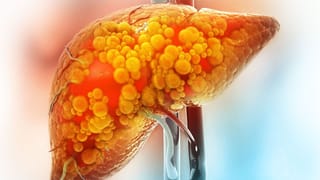 Ginger Tea: చలికాలంలో అల్లం టీ మ్యాజిక్‌‌.. రోజూ తాగితే సంపూర్ణ ఆరోగ్యం గ్యారంటీ!