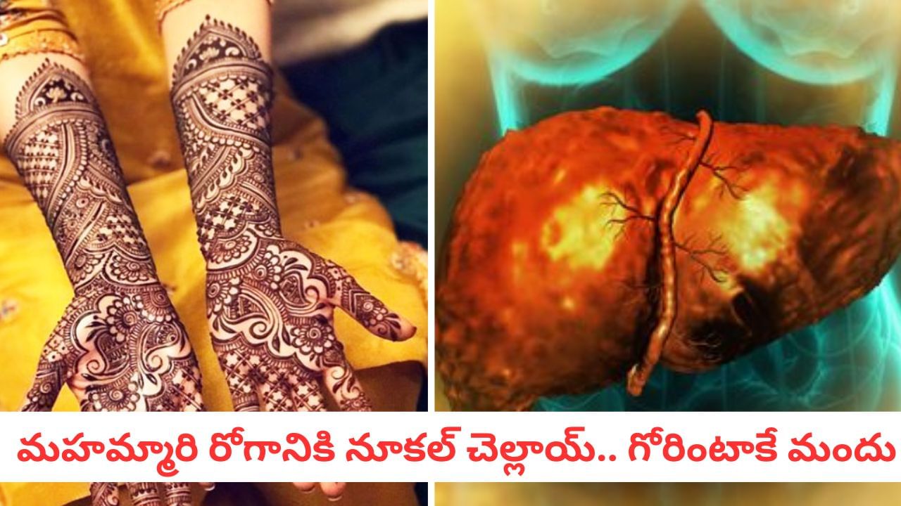 Liver Cure:మందు తాగి లివర్ పాడైందా?.. గోరింటాకే విరుగుడంటున్న సైంటిస్టులు..