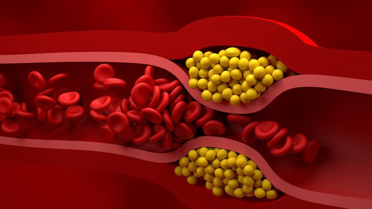 మీరు మీ ఒంట్లో కొలెస్ట్రాల్‌ను తగ్గించుకోవాలనుకుంటే, ముందుగా కొన్ని మార్పులు చేసుకోవాలి. అతి ముఖ్యమైన విషయం ఏమిటంటే మీ ఆహారంలో నూనె పదార్ధాలను తొలగించుకోవాలి. అప్పుడే మీరు ఎప్పుడు ఆరోగ్యంగా ఉంటారు. ఎలాంటి అనారోగ్యం మీ చెంతకు రాదు. 