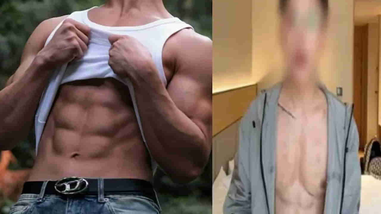 8 ప్యాక్‌ కోసం ఆశపడ్డాడు..ఏకంగా రూ. 5కోట్లు ఖర్చు చేసి చివరికి ఇలా