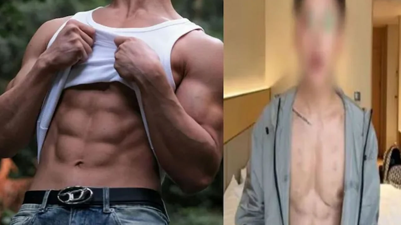 8 ప్యాక్ కోసం ఆశపడ్డాడు..ఏకంగా రూ. 5కోట్లు ఖర్చు చేసి చివరికి ఇలా