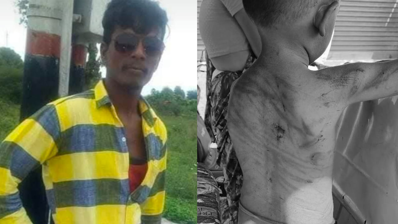 Medak: పసి పిల్లోడురా.. అలా ఎలా కొట్టాలనిపించిందిరా దుర్మార్గుడా..?