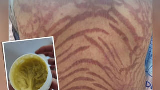 Viral Video: ఎవడ్రా నువ్వు.. మురిగిపోయిన గుడ్డు ఇచ్చావు.. కక్కొస్తుంది బాబోయ్‌..వాక్‌..వాక్‌..