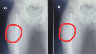 Andhra: అడవిలో కట్టెలు తెచ్చేందుకు వెళ్లాడు.. ఎంతకూ ఇంటికి తిరిగిరాలేదు.. ఆరా తీయగా