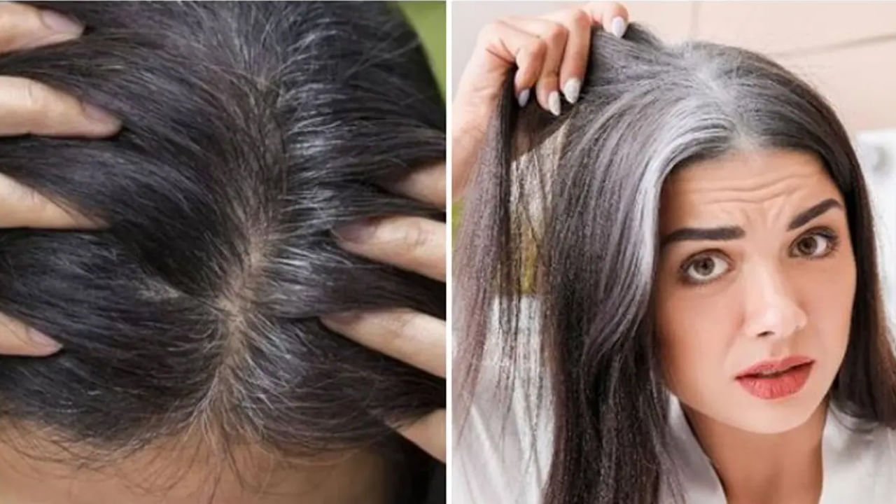 Hair Care: చిన్న వయసులోనే జుట్టు తెల్లబడుతుందా?.. అసలు కారణం ఇదే కావచ్చు.. జాగ్రత్త పడండి