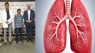 Hyderabad: వైద్య చరిత్రలో మరో అద్భుతం.. 12 ఏళ్ల బాలుడికి యశోద ఆస్పత్రిలో పునర్జన్మ!