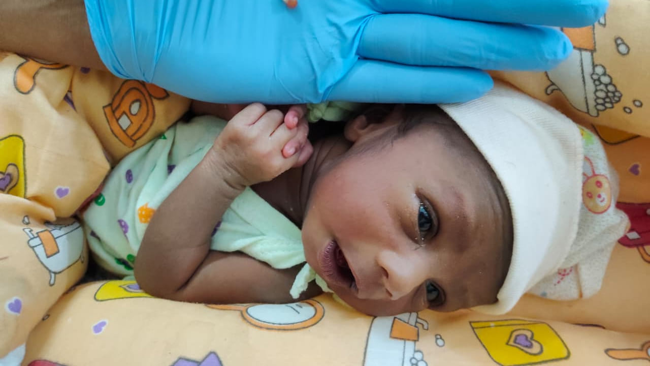 Andhra: అప్పుడే పుట్టిన అరుదైన శిశువు.. తల్లి పాలు ఇస్తుండగా..