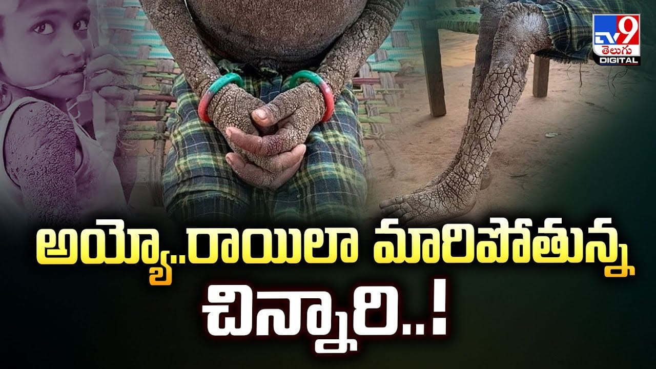 అయ్యో.. రాయిలా మారిపోతున్న చిన్నారి.. ఎందుకిలా