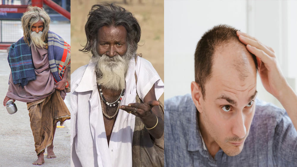 బిచ్చగాళ్లకు ఒత్తైన జట్టు.. మనకేమో బట్టతలలా? దాని వెనకున్న ఈ 5 రహస్యాలు తెలిస్తే షాక్‌ అవ్వాల్సిందే!