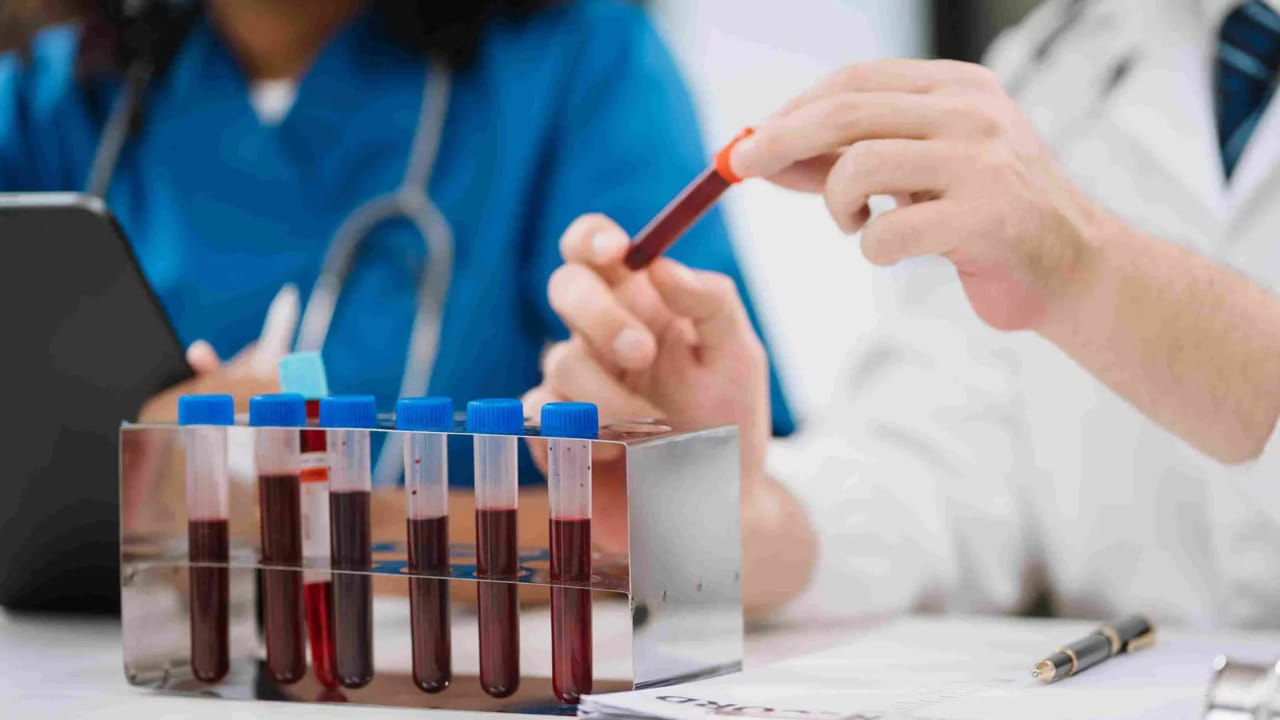 మూత్రపిండాల పనితీరును తనిఖీ చేయడానికి రక్త పరీక్ష:  శరీరంలోని అనేక విషయాలను గుర్తించడానికి రక్త నమూనాలను తీసుకోవచ్చు. అదేవిధంగా, మూత్రపిండాల పనితీరును గుర్తించడానికి రక్త పరీక్షలు ముఖ్యమైనవి. ఈ రక్త పరీక్ష రక్త సీరంలో క్రియేటిన్ స్థాయిని గుర్తించడం. క్రియేటిన్ విచ్ఛిన్నం కారణంగా ఉత్పత్తి అయ్యే వ్యర్థ ఉత్పత్తుల నుండి ఈ సీరం ఏర్పడుతుంది. ఈ స్థాయి మహిళలకు 1.2 కంటే తక్కువగా, పురుషులకు 1.4 కంటే తక్కువగా ఉండాలి. అదనంగా, కాల్షియం, భాస్వరం, గ్లూకోజ్, రక్త యూరియా,  నైట్రోజన్‌ను ఈ పరీక్షలో ఉపయోగిస్తారు.