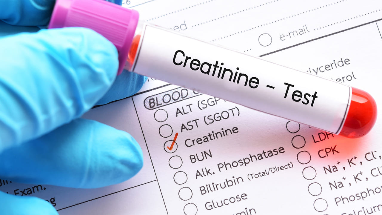 మూత్రపిండాల పనితీరును అంచనా వేయడానికి క్రియాటినిన్, eGFR పరీక్షలు:  మూత్రపిండాల పని వ్యర్థ ఉత్పత్తులను శుద్ధి చేయడం, ఫిల్టర్ చేయడం. ఈ క్రియాటినిన్ పరీక్ష కిడ్నీ పనిని బాగా చేస్తున్నారో లేదో చూడటానికి ఒక పరీక్ష. కొంతమందికి, క్రియాటినిన్ పరీక్ష మాత్రమే కొన్నిసార్లు సరిపోదు. దానితో పాటు eGFR పరీక్ష తీసుకోవడం మంచిది. ఇది మూత్రపిండాల క్రియాత్మక సామర్థ్యాన్ని సూచిస్తుంది. సిస్టాటిన్ సి ఒక ప్రోటీన్. దీని స్థాయిలు మూత్రపిండాల ఆరోగ్యాన్ని ఖచ్చితంగా సూచిస్తాయి. అధిక కండర ద్రవ్యరాశి ఉన్నవారిలో లేదా సప్లిమెంట్లు తీసుకునేవారిలో, క్రియాటినిన్ కొన్నిసార్లు తక్కువ స్థాయిలను చూపుతుంది.