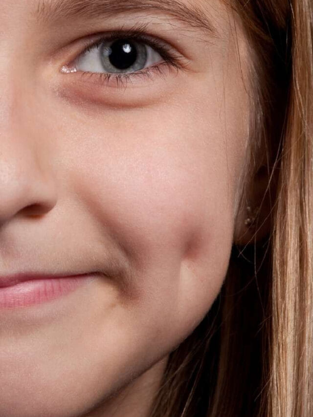 బుగ్గపై సొట్ట ఉన్న అబ్బాయిలు, అమ్మాయిలు.. ఇందులో ఎవరికి ఎక్కువ అదృష్టం అంటే?