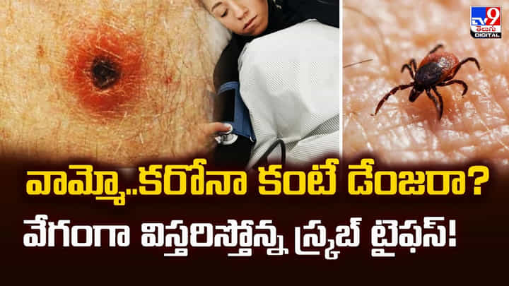వామ్మో.. కరోనా కంటే డేంజరా ?? వేగంగా విస్తరిస్తోన్న స్క్రబ్ టైఫస్! వామ్మో.. కరోనా కంటే డేంజరా ?? వేగంగా విస్తరిస్తోన్న స్క్రబ్ టైఫస్!