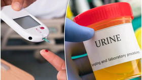 మూత్రం మండడం మధుమేహానికి సంకేతమా? నిపుణులు ఏమంటున్నారు?