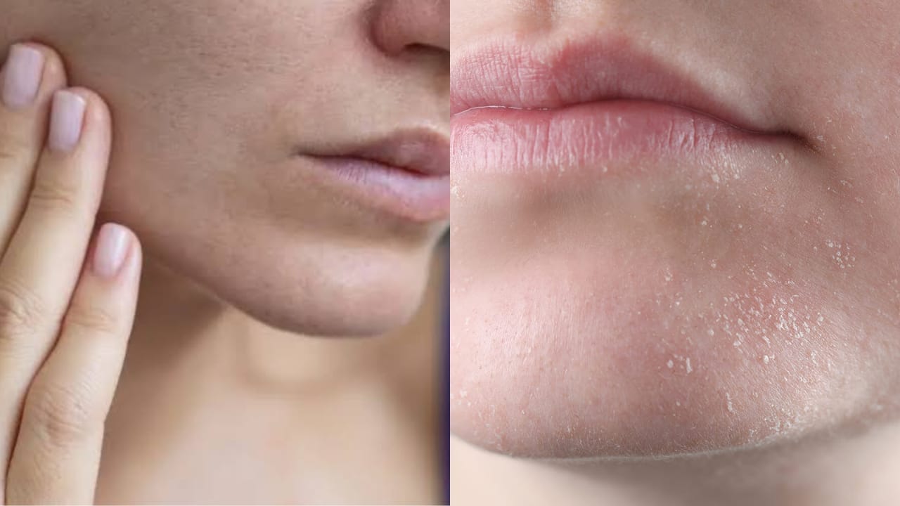 Winter: చలికి చర్మం పగులుతోందా.. స్కిన్‌ను మృదువుగా చేసుకునే టిప్స్ మీకోసం!