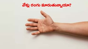 చలికి చేతి వేళ్లు నీలం రంగులోకి మారుతున్నాయా..?