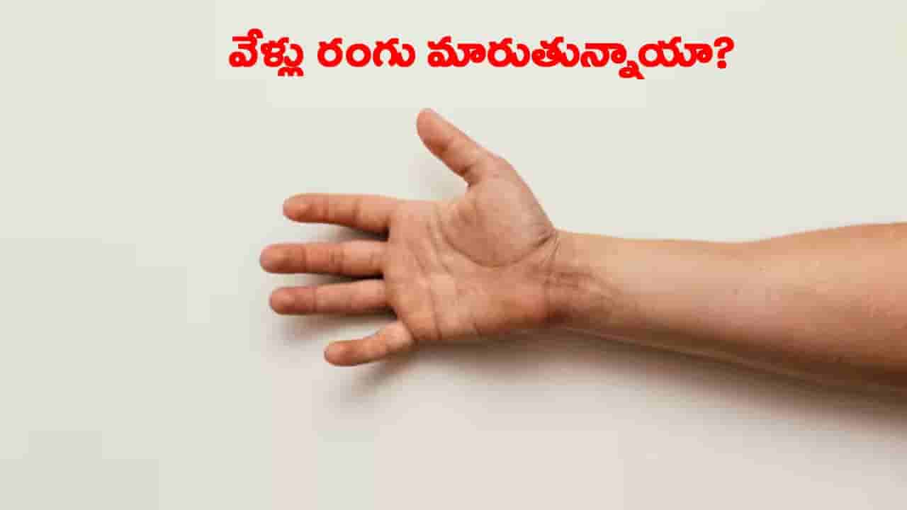 చలికి చేతి వేళ్లు నీలం రంగులోకి మారుతున్నాయా..? శరీరంలో ఏ లోపం ఉందో తెలుసా?