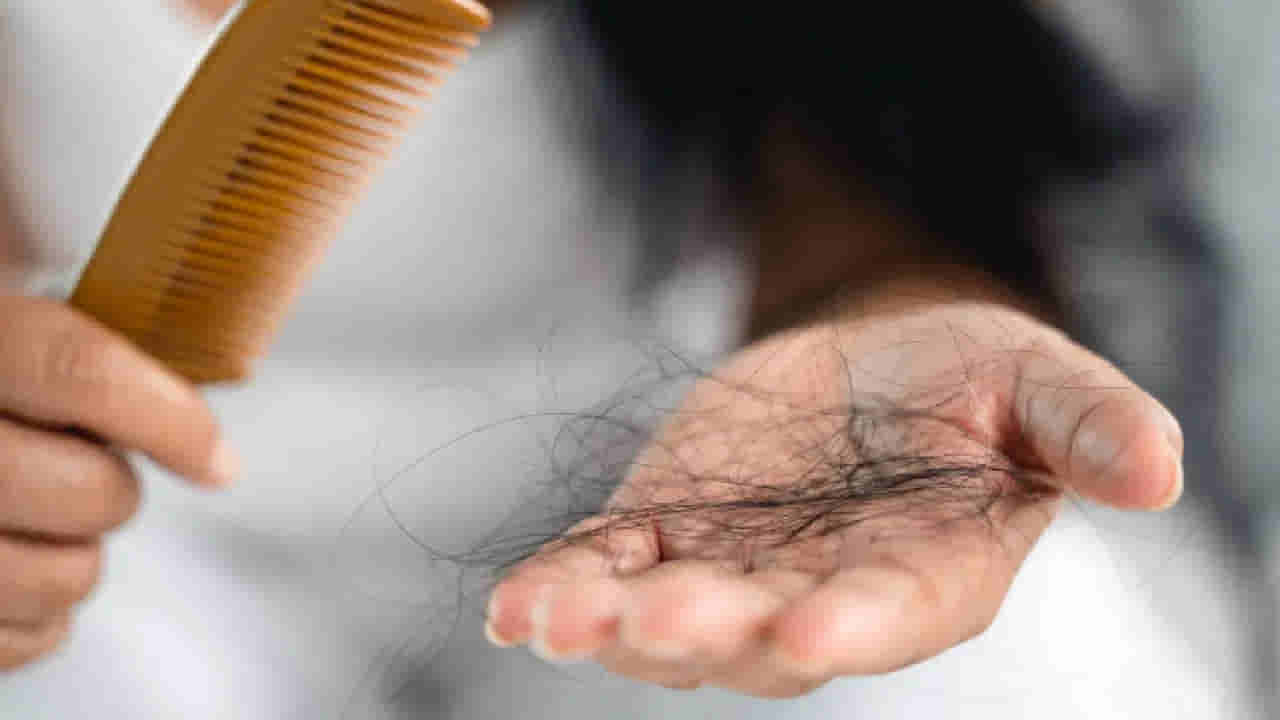 Hair Loss: ఈ ఆహారాలు తింటే బట్టతల గ్యారెంటీ..! కాస్త చూస్కోండి
