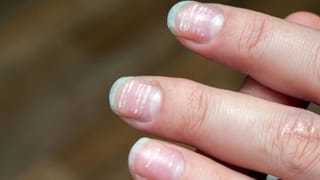 Health alert: ఈ ప్రాణాంతక వ్యాధుల నుంచి రక్షణ పొందండిలా!