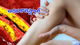 అధిక కొలెస్ట్రాల్ ప్రారంభ సంకేతాలు ఎలా ఉంటాయి.?నిర్లక్ష్యం చేస్తే