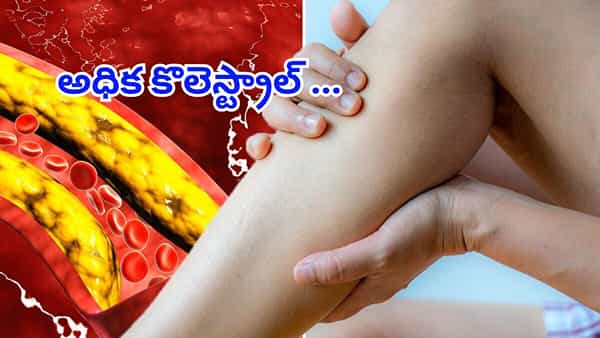 అధిక కొలెస్ట్రాల్ ప్రారంభ సంకేతాలు ఎలా ఉంటాయి..? నిర్లక్ష్యం చేస్తే జరిగేది ఇదే..!