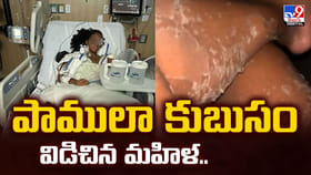 బాబోయ్.. పాములా కుబుసం విడిచిన మహిళ.. ఇది ఎలా సాధ్యం