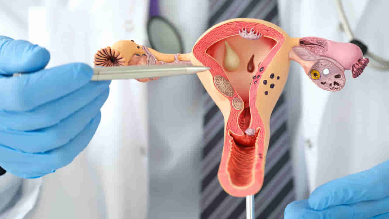 Health: స్త్రీలలో గర్భసంచి తీసేస్తే ఈ సమస్యలు తప్పవు..!