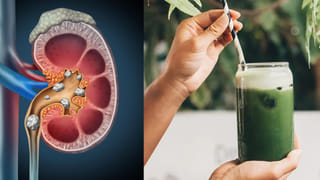 ఈ జ్యూస్ తాగారంటే.. కిడ్నీలో రాళ్లు ఇట్టే కరిగిపోతాయి..