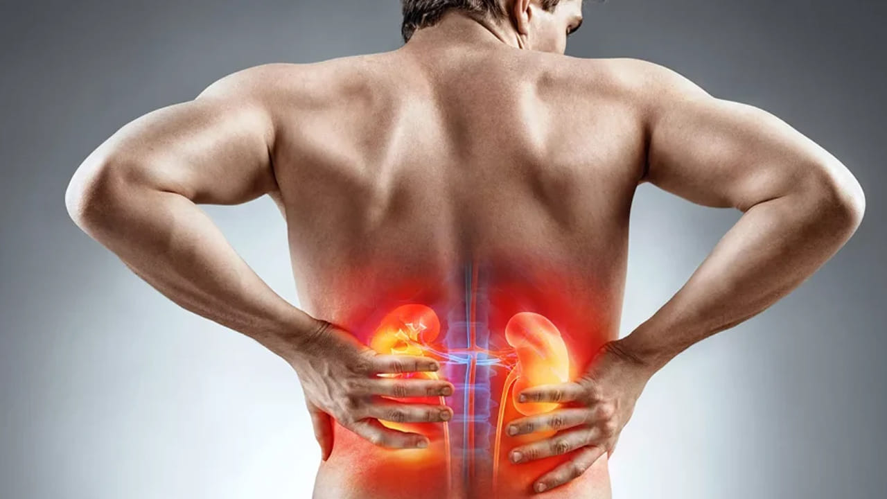 మూత్రపిండాల్లో రాళ్లకు కారణాలు: మూత్రపిండాల్లో రాళ్లు ఏర్పడటానికి వివిధ కారణాలు ఉన్నాయి. వాటిలో ముఖ్యమైనవి తగినంత నీరు త్రాగకపోవడం వల్ల కలిగే నిర్జలీకరణం, ఊబకాయం, వ్యాయామం లేకపోవడం, మధుమేహంతో సహా జీవక్రియ రుగ్మతలు, అనారోగ్యకరమైన జీవనశైలి అలవాట్లు, అధిక సోడియం తీసుకోవడం వంటివి.