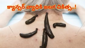 జలగ చికిత్స క్యాన్సర్‌ను నయం చేయగలదా? నిపుణులు ఏం చెబుతున్నారంటే.