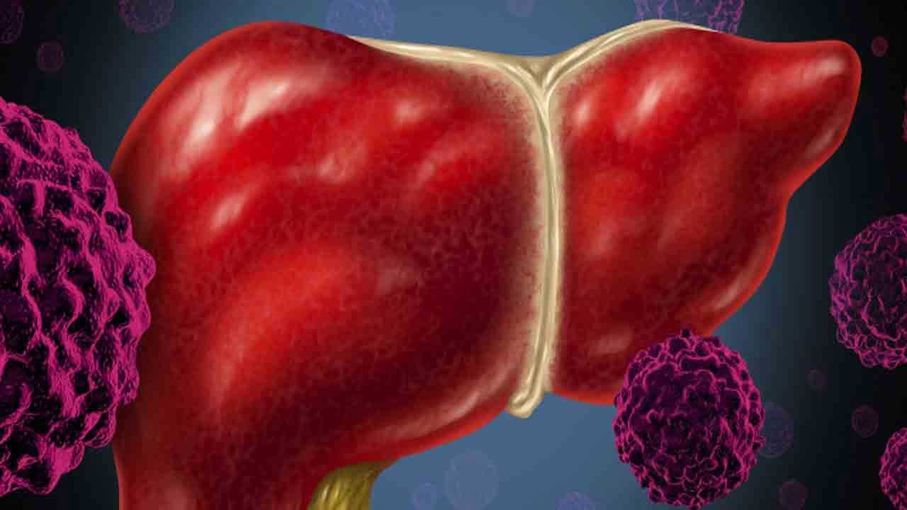 బరువు తగ్గడం కూడా కాలేయ క్యాన్సర్ సంకేతమే. మీరు అనుకోకుండా ఒక్కసారిగా బరువు వేగంగా తగ్గుతున్నట్లు అయితే అది కాలేయ క్యాన్సర్కు సంకేతం. కణతి కారణంగా శక్తి వేగంగా క్షీణిస్తుంది. దీని వలన వేగంగా బరువు తగ్గుతుంటారు.