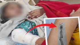 ప్రియురాలు మాట్లాడటం మానేసిందని..!