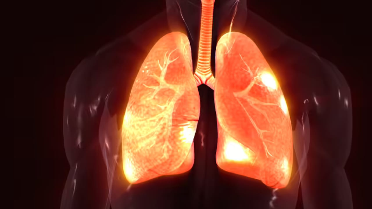 ఊపిరితిత్తుల సామర్థ్యంపై ప్రభావం:  గాలి నాణ్యత సూచిక స్థాయిలలో నిరంతర మార్పులు వివిధ ఆరోగ్య సమస్యలు, పర్యావరణ సమస్యలను కలిగిస్తాయి. ముఖ్యంగా గాలి నాణ్యత సూచిక స్థాయి చాలా పేలవంగా ఉండి చాలా కాలం పాటు కొనసాగినప్పుడు, అది ఊపిరితిత్తుల సామర్థ్యం తగ్గడానికి కారణమవుతుంది. అంటే, పల్మనరీ ఫైబ్రోసిస్ అభివృద్ధి చెందే అవకాశాలు చాలా ఎక్కువగా ఉన్నాయని అనేక వైద్య అధ్యయనాలు నిరూపించాయి.