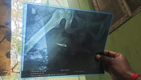 ఓరీ దేవుడో.. యువతి శరీరంలో బ్లేడును వదిలేసి ఆపరేషన్‌..