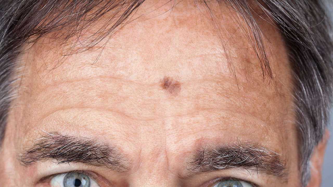 సముద్ర శాస్త్రం ప్రకారం.. పుట్టుమచ్చలు నుదిటిపై ఉంటే.. దాన్ని చాలా శుభప్రదంగా భావిస్తారు. ఇక్కడ పుట్టుమచ్చ ఉన్న వ్యక్తులు.. ధన కొరతను ఎప్పుడూ చూడరు. అదృష్టం వరిస్తుంది. అదే విధంగా గొంతు దగ్గర పుట్టుమచ్చ ఉన్నా శుభమే.