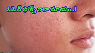 Grey Hair Remedies: తెల్ల జుట్టుకు శాశ్వత పరిష్కారం ఉందా! డాక్టర్లు చెబుతున్న సీక్రెట్స్ ఇవే!