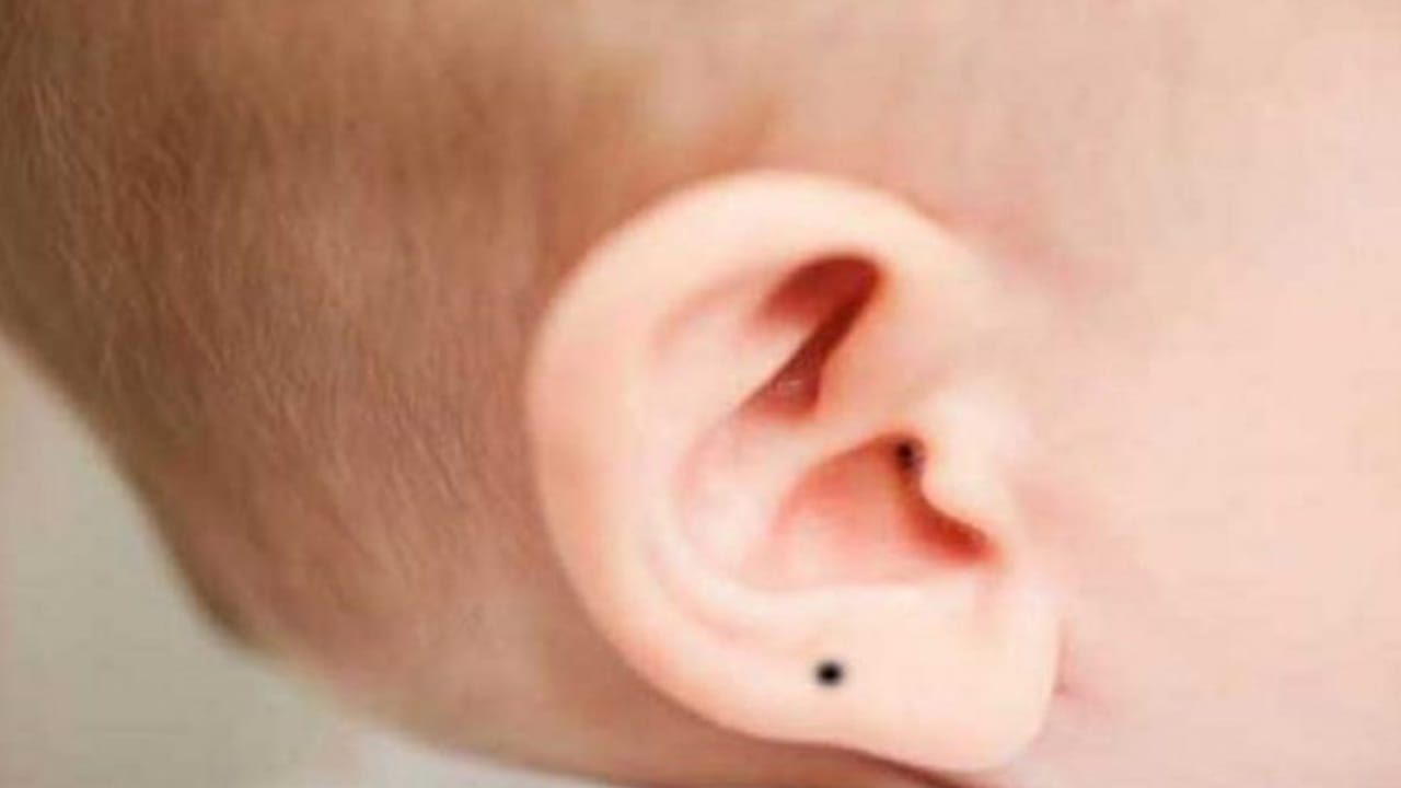 ఇక ఏ వ్యక్తి అయితే చెవిపై పుట్టుమచ్చ ఉంటుందో, ఆ వ్యక్తి చాలా ఆదధ్యాత్మిక అవగాహన కలిగిన వ్యక్తి, గత జన్మలో ఆయన ఎక్కువగా భక్తిలో మునిగిపోయారని అర్థం. అలాగే నడుము పై లేదా నడుము కింది భాగంలో గనుక పుట్టు మచ్చ ఉన్నట్లు అయితే, ఆ వ్యక్తి గతంలో దోపిడికి గురి అయ్యాడని, చాలా ఇబ్బందులు ఎదుర్కున్నారని అర్థం అంట.