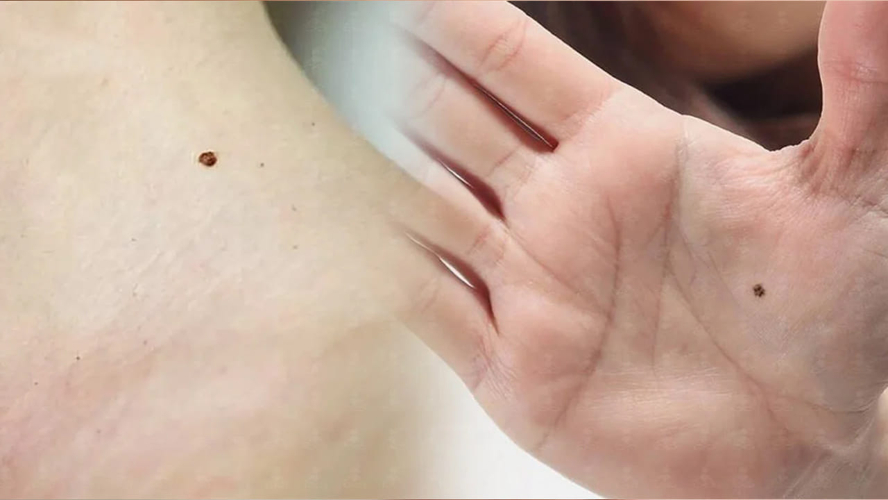 అదే విధంగా ఏ వ్యక్తికి అయితే చేతులపై ఏ ప్రదేశంలోనైనా సరే పుట్టు మచ్చ ఉంటే, అతను గత జన్మలో సక్సెస్ అవ్వడానికి చాలా ప్రయత్నం చేసినా, విజయం వరించలేదని, దాని పశ్చా్త్తాపం ఇప్పటికీ ఆయనను వేధిస్తుందని అర్థం, అలాగే కాళ్లపై ఉంటే, అతను తన బంధువుల నుంచి అనేక ఇబ్బందులు పడ్డాడని అర్థం అంటున్నారు నిపుణులు.