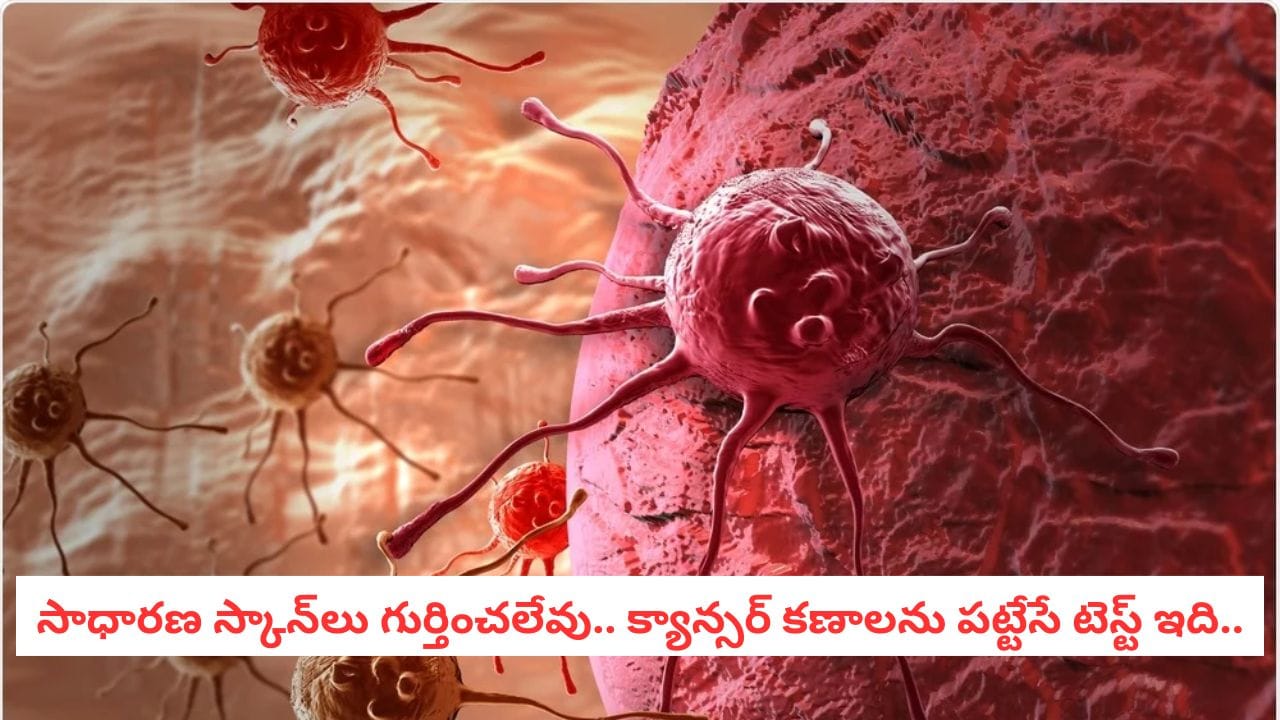 Cancer Detection: శరీరంలో క్యాన్సర్ ఉందా? ఈ ఒక్క పరీక్షతో ఫుల్ క్లారిటీ.. మిస్ చేయకండి!