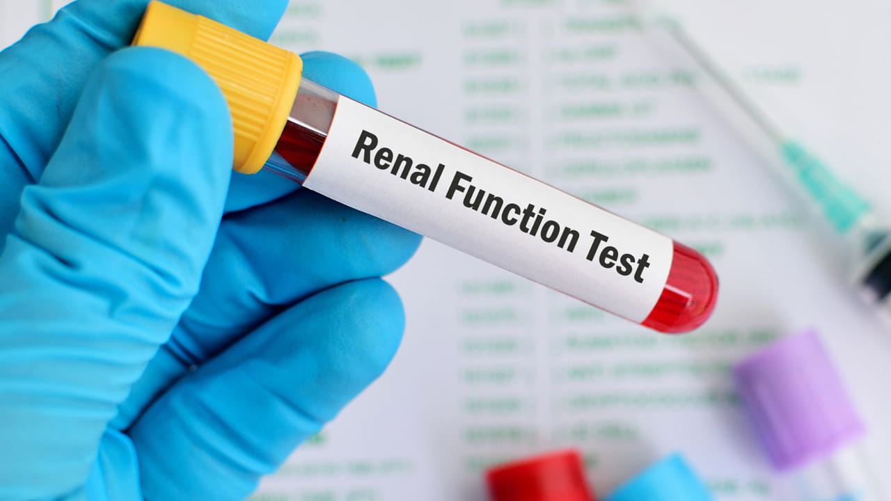 మూత్రపిండాల పనితీరు పరీక్షలు అంటే ఏంటి?:  కిడ్నీ ఫంక్షన్ పరీక్షలు, సాధారణంగా KFT లేదా RFT అని పిలుస్తారు, ఇవి మన మూత్రపిండాలు సరిగ్గా పనిచేస్తున్నాయో లేదో నిర్ణయించే పరీక్షలు. మన శరీరం నుండి వ్యర్థ ఉత్పత్తులను, అదనపు లవణాలను తొలగించడానికి మూత్రపిండాలు బాధ్యత వహిస్తాయి. కిడ్నీ ఫంక్షన్ పరీక్షలు యూరియా, క్రియేటినిన్, యూరిక్ యాసిడ్, సోడియం, పొటాషియం వంటి లవణాల స్థాయిలను గుర్తించడంలో సహాయపడతాయి.