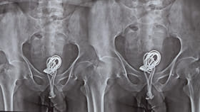 ఏమో గుర్రానికి రెక్కలొచ్చే.! ప్రైవేట్ పార్టులో నొప్పితో ఆస్పత్రిక